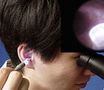 a guide to international certifications in manual instrument ear wax removal 2