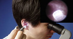 a guide to international certifications in manual instrument ear wax removal