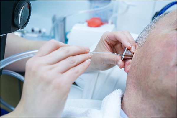 assessing whether professional ear wax removal is right for you