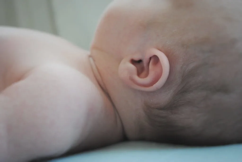cautionary considerations: identifying those who should steer clear of microsuction 1